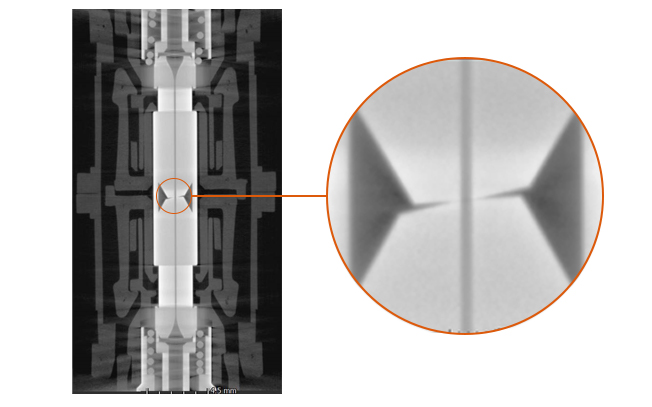 MRI view of the plug