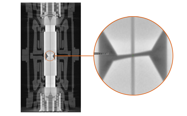 MRI view of the contaminated plugs